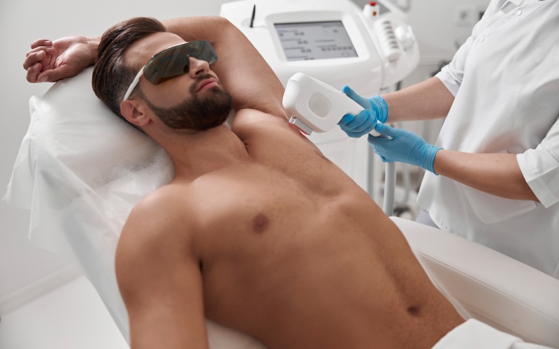 L’épilation laser est-elle efficace pour les hommes ? | Dr Martin-Chico | Bordeaux